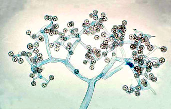 Esporangiforo ramificado de
              Thamnidium elegans con esporangiolos